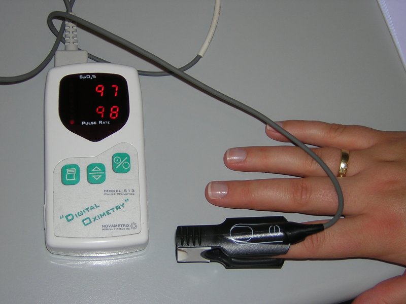 Datei:Pulsoximeter.jpg