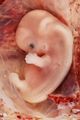 Datei:80px-Embryo.jpg