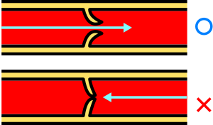 Datei:300px-Venous valve Red.svg.png