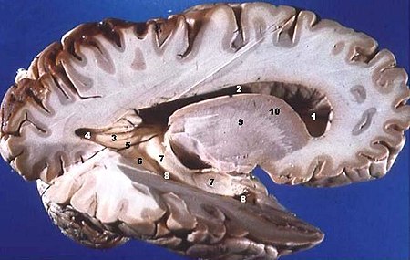 Graue Substanz AnthroWiki