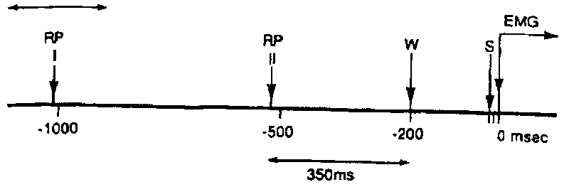 Datei:1200px-Libet 2.gif