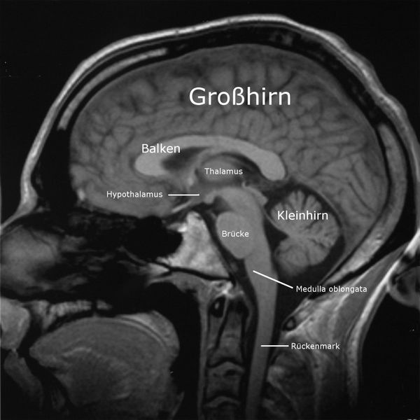 Gehirn AnthroWiki