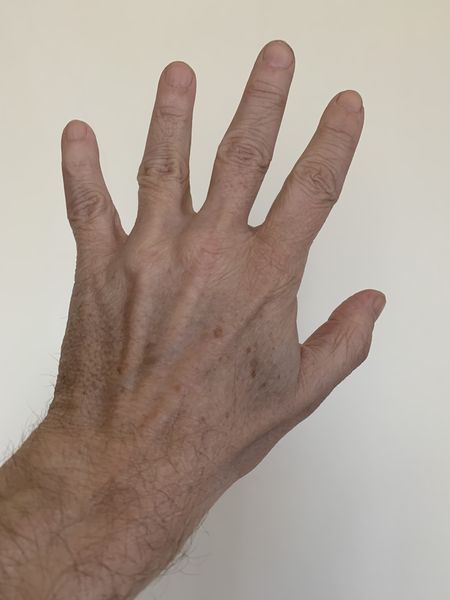 Datei:Linke Hand 2.jpg