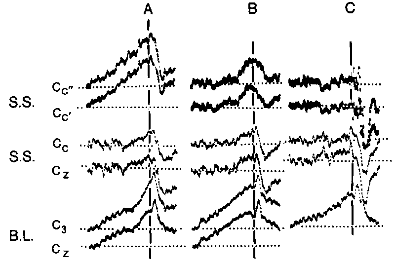 Datei:1024px-Libet 1.gif