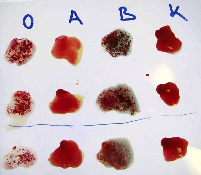 Datei:1037px-BlutAgglutination.JPG