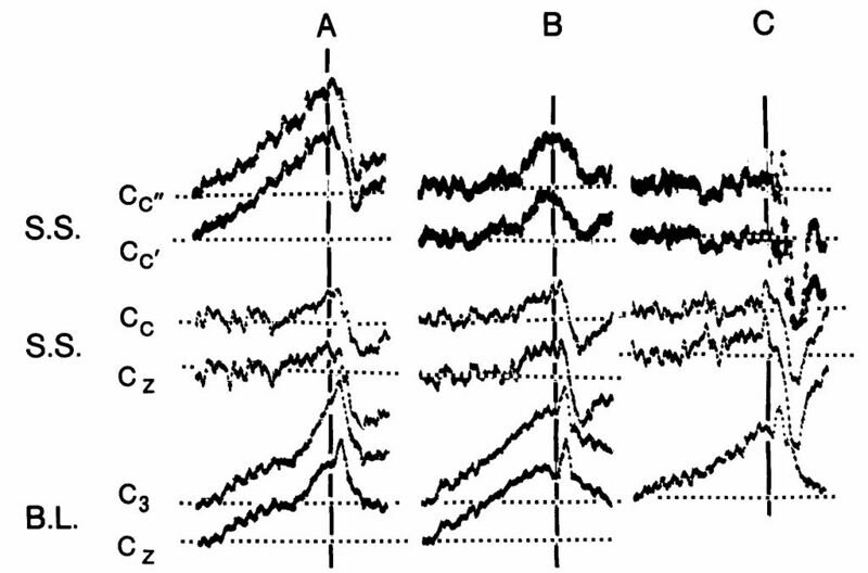 Datei:1024px-Libet 1.jpg