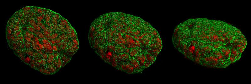 Datei:1080px-3D-SIM-2 Nucleus prophase 3d rotated.jpg