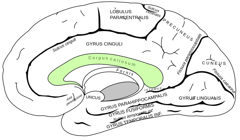 Datei:1600px-CorpusCallosum.svg.png