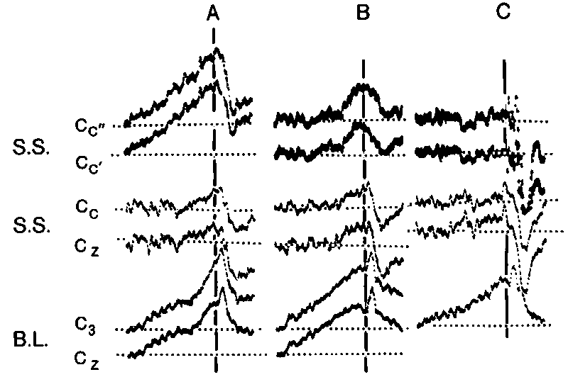 Datei:1600px-Libet 1.gif