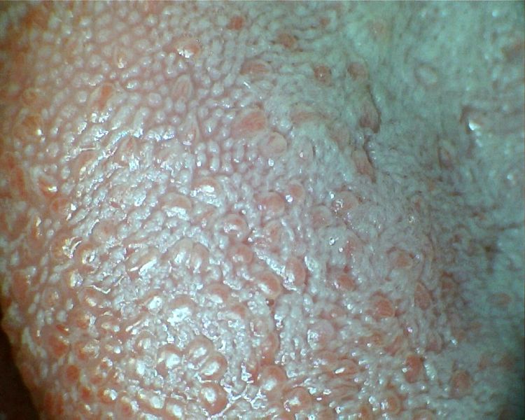 Datei:Tongue and taste buds.jpg