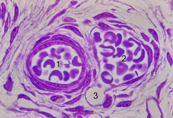 Arteriole – AnthroWiki